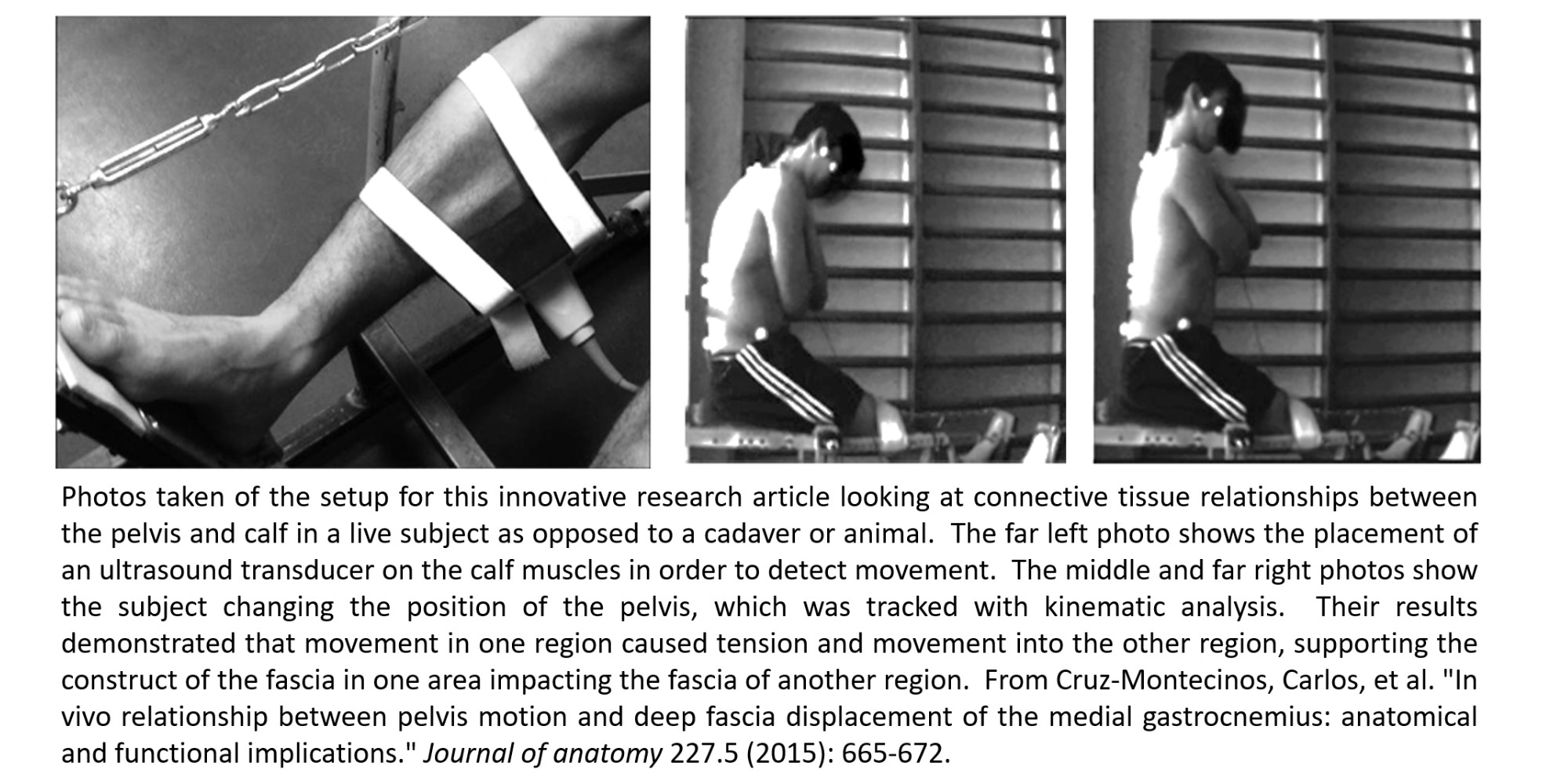 Pelvic Calf Study