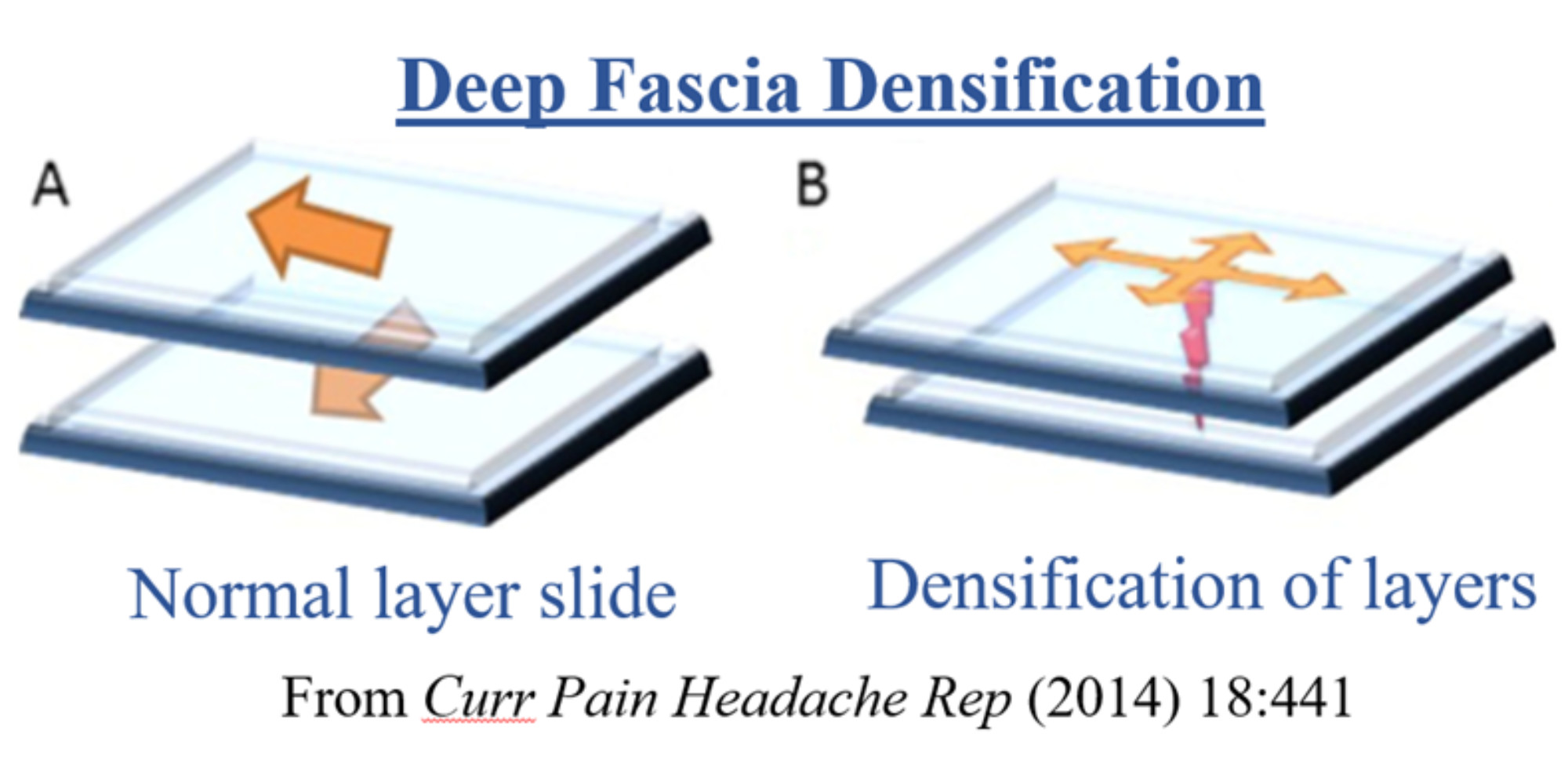 Densification