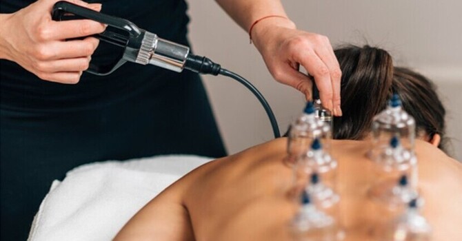 Cupping Therapy